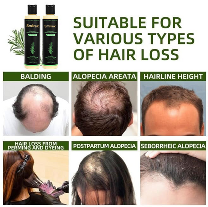 🔥LAST DAY 50% OFF - 🌿Smivex® Organic Rosemary Hair Growth Shampoo
