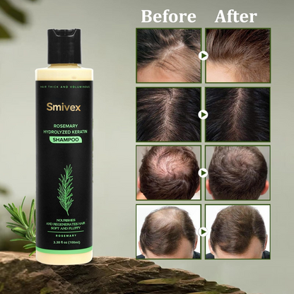 🔥LAST DAY 50% OFF - 🌿Smivex® Organic Rosemary Hair Growth Shampoo