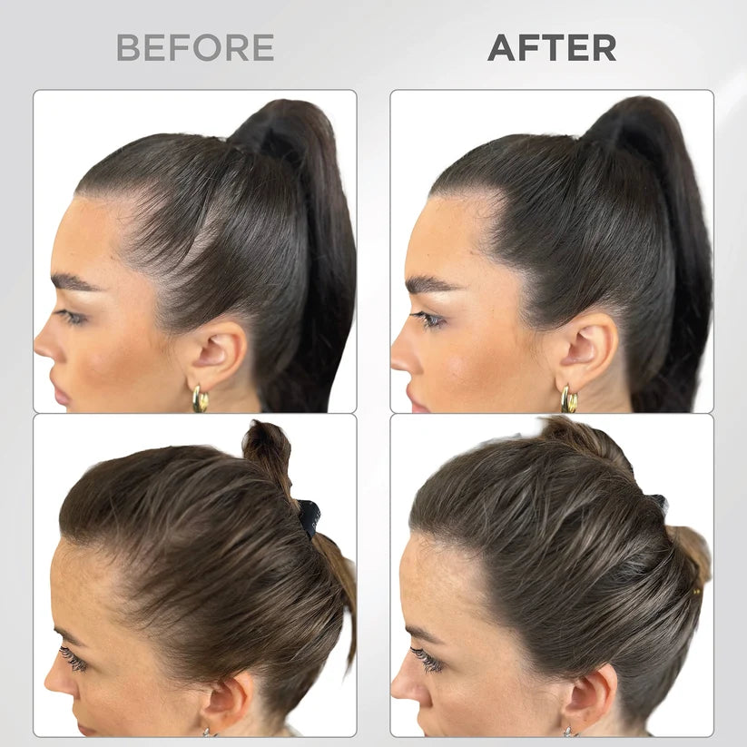 Root Touch Up Powder—Fuller-Looking Hairline In Just 60 Seconds