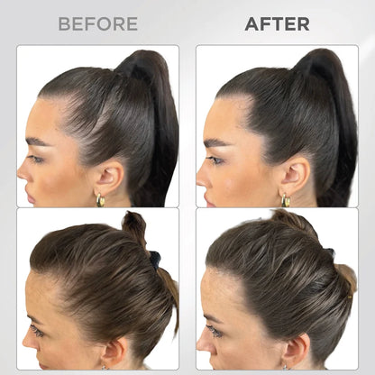 Root Touch Up Powder—Fuller-Looking Hairline In Just 60 Seconds